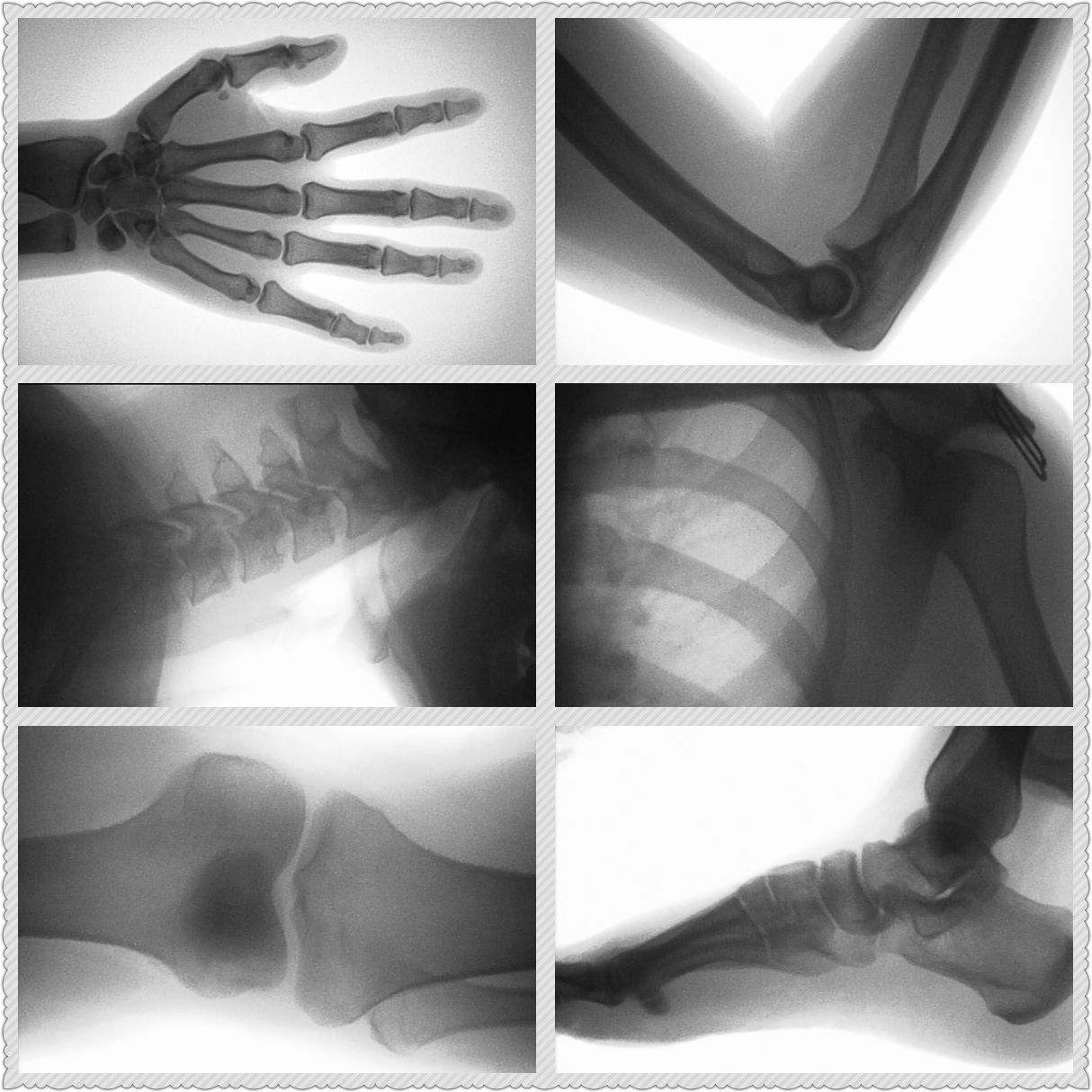 Evcil Hayvanlarda, Kedilerde,  - Veterinary X-Ray incelemesi ve fiyatı